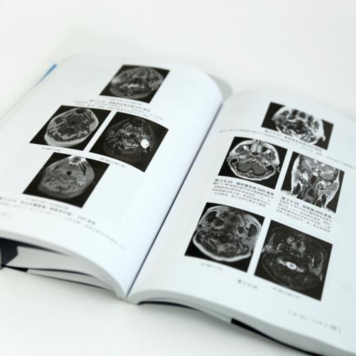 影像鉴别诊断一目了然系列--MRI鉴别诊断一点通（第四版） 商品图5