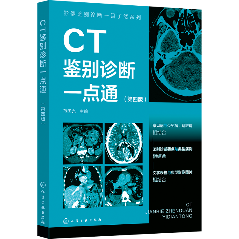 影像鉴别诊断一目了然系列--CT鉴别诊断一点通（第四版）