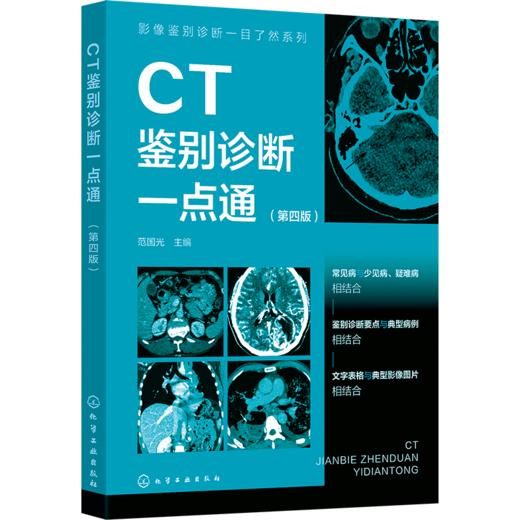 影像鉴别诊断一目了然系列--CT鉴别诊断一点通（第四版） 商品图0