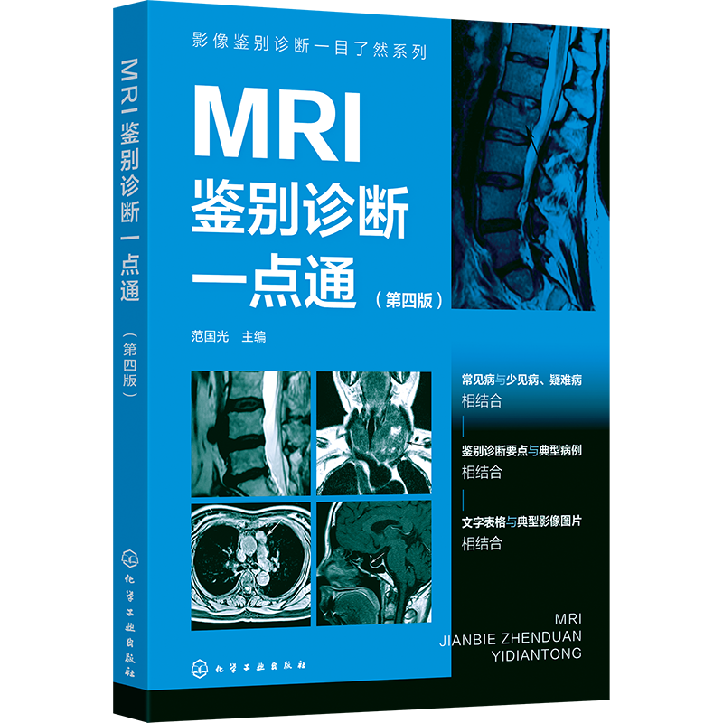 影像鉴别诊断一目了然系列--MRI鉴别诊断一点通（第四版）