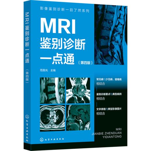 影像鉴别诊断一目了然系列--MRI鉴别诊断一点通（第四版） 商品图0