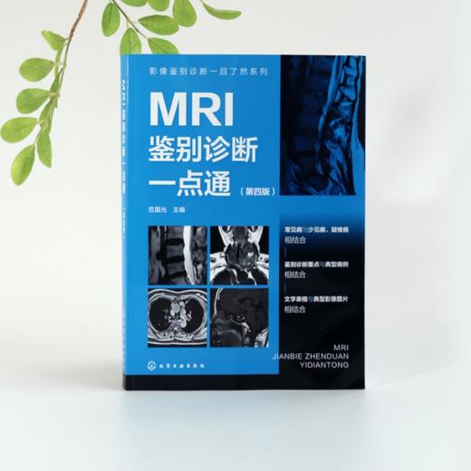 影像鉴别诊断一目了然系列--MRI鉴别诊断一点通（第四版） 商品图1