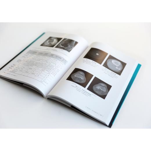 影像鉴别诊断一目了然系列--CT鉴别诊断一点通（第四版） 商品图4