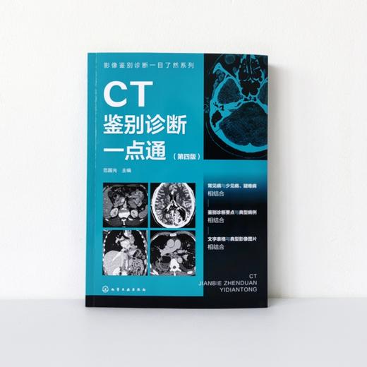 影像鉴别诊断一目了然系列--CT鉴别诊断一点通（第四版） 商品图1