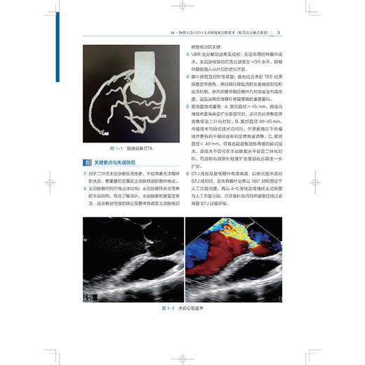 微创心脏外科手术精粹 CMC直播手术病例精选 王春生 配有丰富的手术视频二维码 读者通过扫码即可观看手术视频 上海科学技术出版社 商品图4
