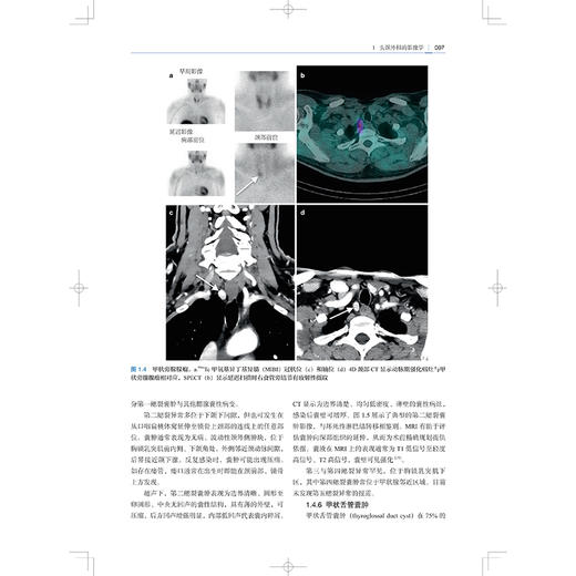 实用头颈外科手术 沈志森 裘世杰 叶栋 邓红霞 主译 涵盖了对头颈部精细解剖结构的深入解读 9787547873458 上海科学技术出版社 商品图4