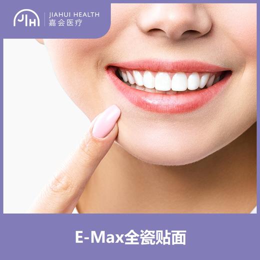 仅限苏州 E-MAX全瓷贴面 商品图0