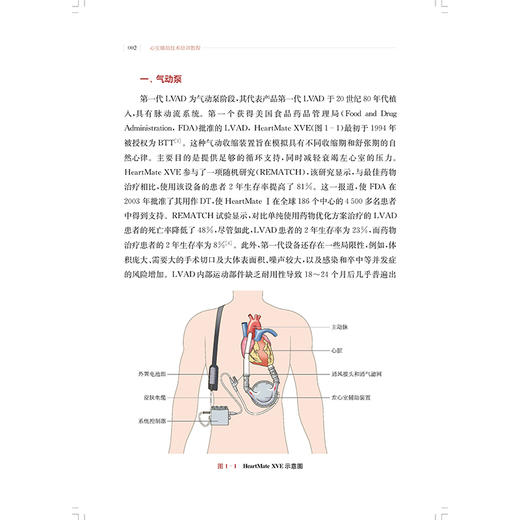 心室辅助技术培训教程 孙晓宁 主编 本书围绕诊断和治疗终末期心力衰竭的主题 临床医学 9787547873908 上海科学技术出版社 商品图4
