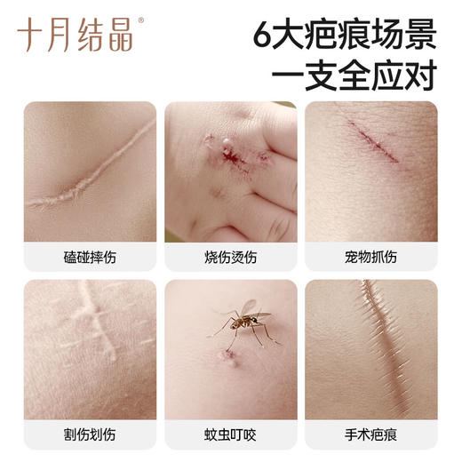 医用硅酮儿童祛疤药膏修护祛疤凝胶小孩烫伤疤痕增生专用 商品图1