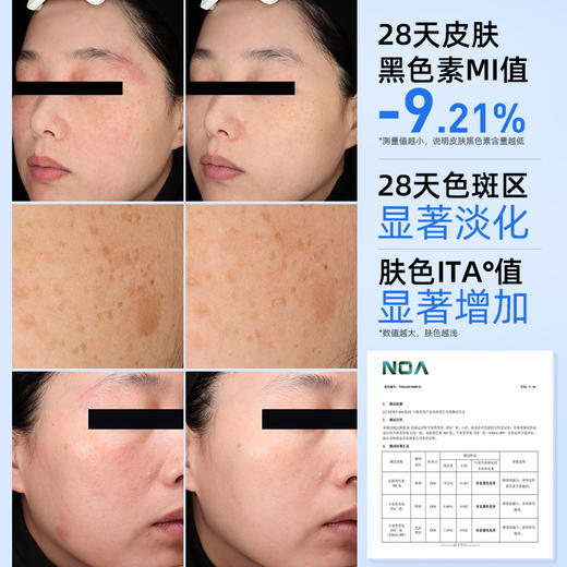 保税直发 Dynveo 白月光套组（脂质体VC 60粒/瓶x1瓶+倍递脂质体谷胱甘肽  60粒/瓶x1瓶） 商品图2