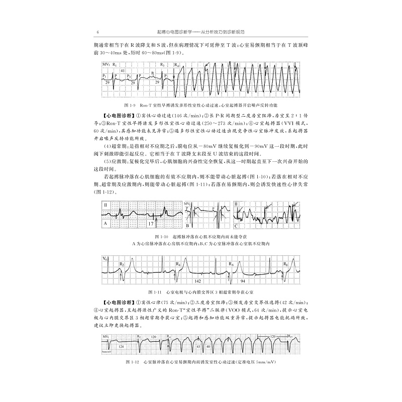 试读PDF-9787308267700(1-1)-起搏心电图诊断学:从分析技巧到诊断规范_019.jpg