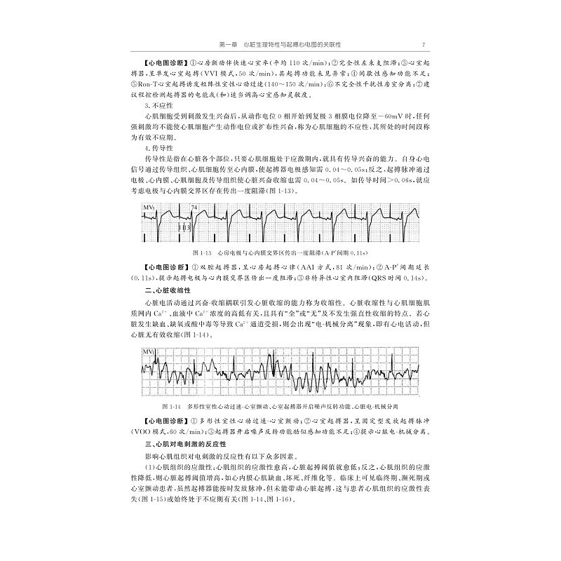 试读PDF-9787308267700(1-1)-起搏心电图诊断学:从分析技巧到诊断规范_020.jpg