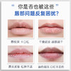 【品牌直发】【法国原装】蕾娜修护滋养润唇膏4g【冬季必备明星品】 商品缩略图2