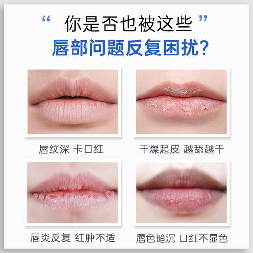 【品牌直发】【法国原装】蕾娜修护滋养润唇膏4g【冬季必备明星品】 商品图2