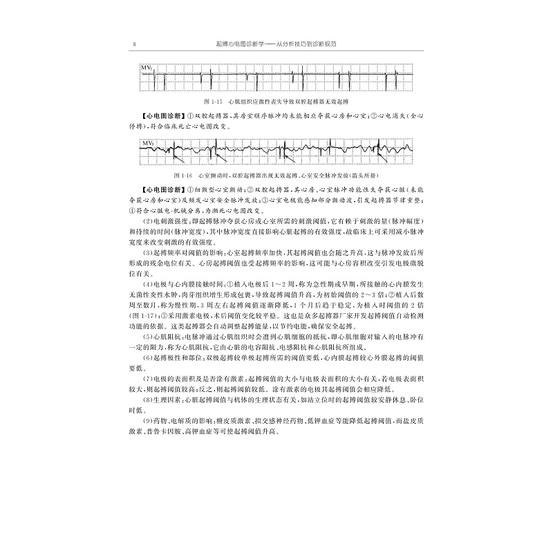 试读PDF-9787308267700(1-1)-起搏心电图诊断学:从分析技巧到诊断规范_021.jpg
