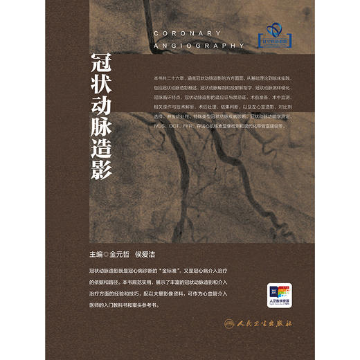 冠状动脉造影 商品图1