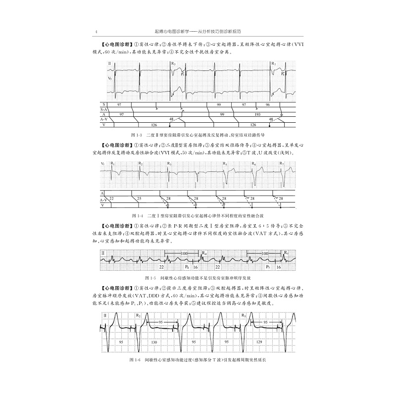 试读PDF-9787308267700(1-1)-起搏心电图诊断学:从分析技巧到诊断规范_017.jpg