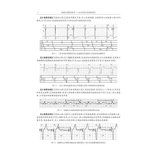 起搏心电图诊断学/何方田 著/浙江大学出版社 商品图1