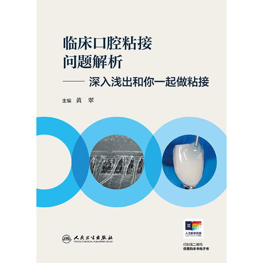 临床口腔粘接问题解析——深入浅出和你一起做粘接 商品图1