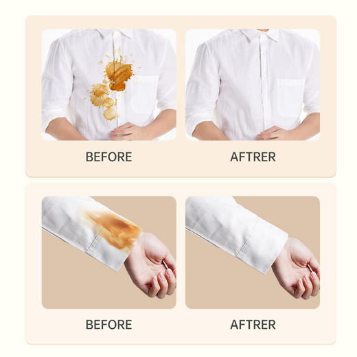 【秒杀7.9抢❗️20片🔥衣物去污湿巾】一次性羽绒服湿巾，20片独立小包装，便携装有效去污免洗湿巾L 商品图3