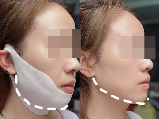 【紧致提拉 重塑下颌线】彤人秘V脸塑颜膜（5片/盒）*2盒 商品图4
