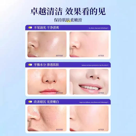 日本  Alovivi娥佩兰 天然萃取皇后薏仁美容爽肤水 300ml 商品图7