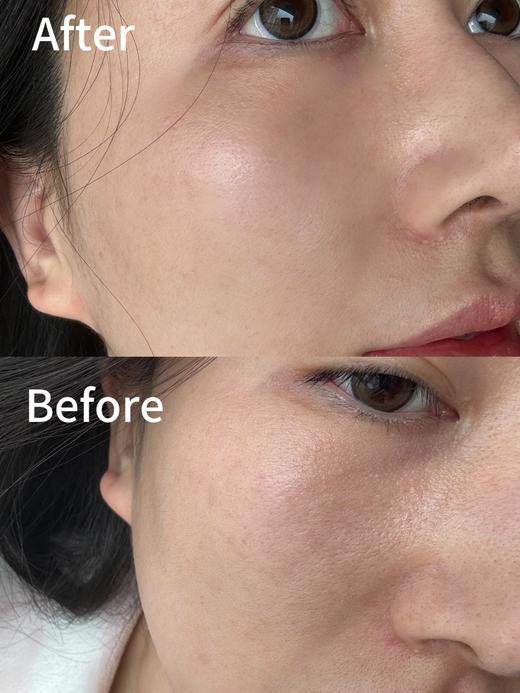 72小时发货【amiro 水光炮】在家做水光，3分钟焕活胶原弹润肌~无痛水光，深度吸收，即刻提拉营养成分深入肌底，有效深层补水抗衰紧致提拉，瘦脸去水肿，方波体感更舒适 商品图14