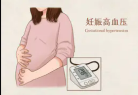 孕期知识分享#孕期高血压