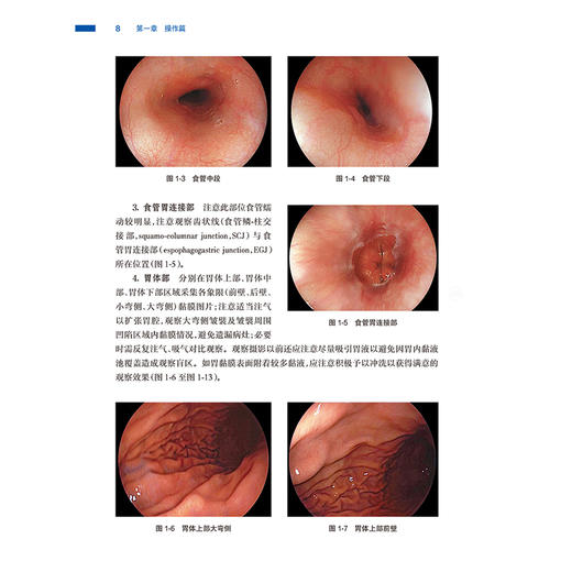 中西医结合消化内镜学 魏玮 李兆申 全面地阐述了常见内镜操作要点 也涵盖了常见消化内镜治疗指南 9787117382014 人民卫生出版社 商品图4