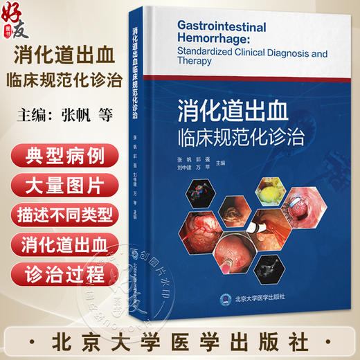 消化道出血临床规范化诊治 张帆 郭强 刘中建 万苹 主编 消化系统疾病 出血性疾病 诊疗 9787565933042 北京大学医学出版社 商品图0