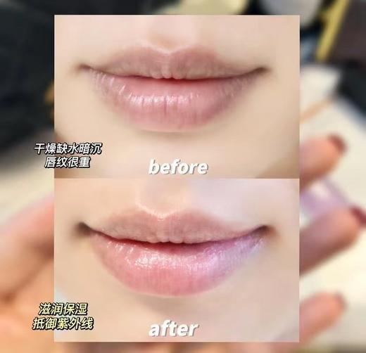 2件包邮【现货】【销量过亿，去死皮滋润保湿】【唇膏润唇界常青树 老网红小蓝罐】【干裂唇纹说拜拜👏】【嘴唇嘟嘟嫩到不行】【经典原味、薄荷味、浆果味】 商品图6