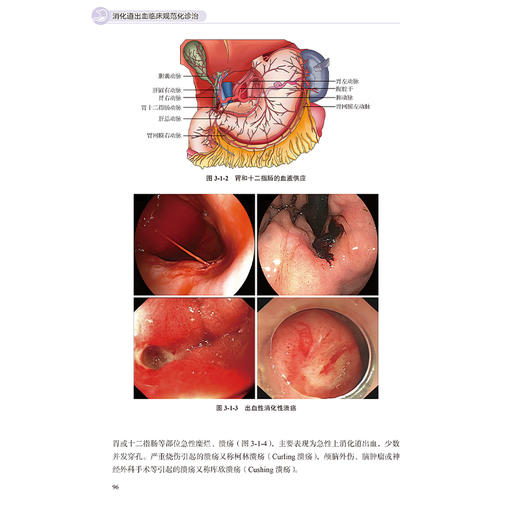 消化道出血临床规范化诊治 张帆 郭强 刘中建 万苹 主编 消化系统疾病 出血性疾病 诊疗 9787565933042 北京大学医学出版社 商品图3