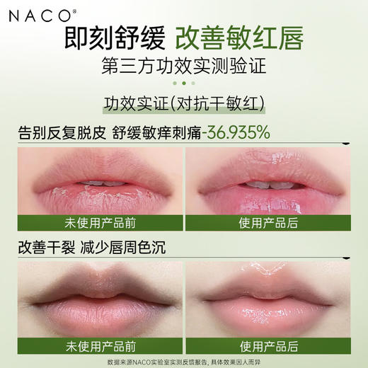 【老客专享福利】NACO植萃高保湿润唇膏3g/支 #舒缓敏唇·柔润保湿·亮泽抚纹 商品图1