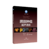 胰腺肿瘤超声造影 商品缩略图0