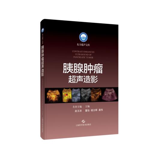 胰腺肿瘤超声造影 商品图0