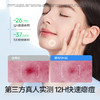 【秒杀品】海龟爸爸日夜隐形痘痘贴 | 0.01cm超薄设计、贴合肌肤、帮助痘痘快速干瘪、撕除不残胶、适合13岁+青少年日常使用 商品缩略图2