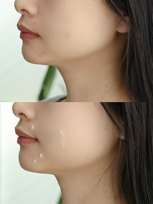 【新包装50g】升级祛痘膏【 0激素】 不含激素、抗生素、酒精 湖州仓 商品图4