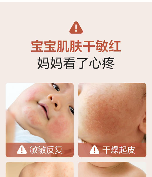 妙抚MANAFEEL妙抚皮肤多效舒缓精华霜（湿湿乐）三件套50g+20g+20g 商品图2