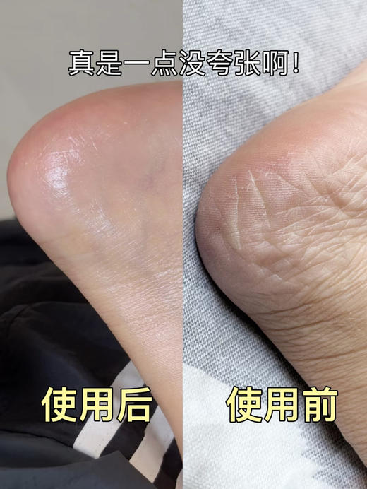 好用到神奇！澳洲HAAB乳木果油手足膏持久兹润防护改善粗糙暗沉 商品图7