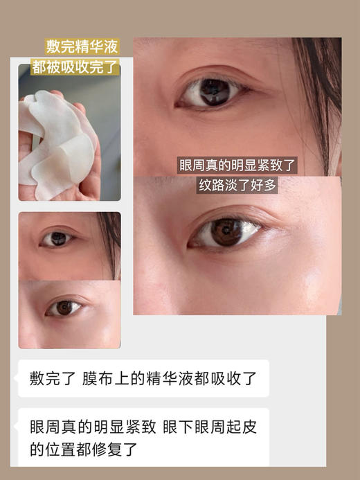 限定版！送冰波球！日本Spa Treatment蛇毒眼膜70枚/盒 商品图10