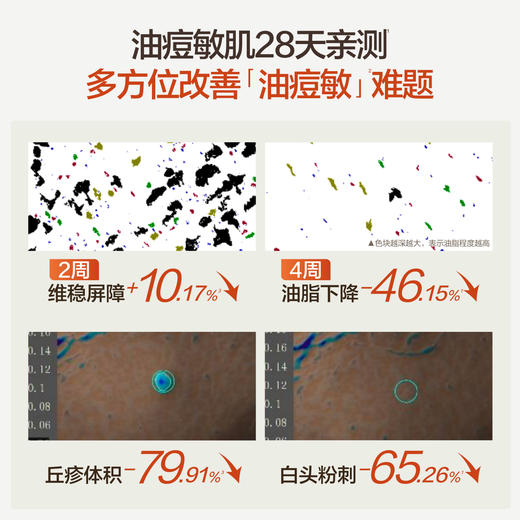 HBN控油精粹水乳套组祛痘油皮敏感肌修护保湿爽肤水 商品图2