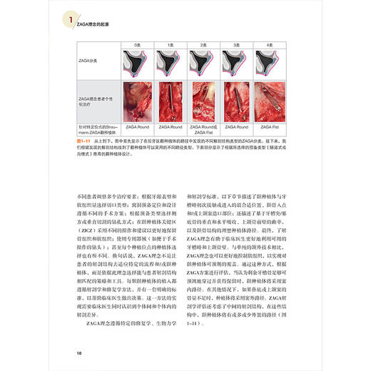 【出版社代发】高阶颧种植 ZAGA理念 刘体亮 王宁涛 袁赟 主译 ZAGA解剖引导个体化入路 精准把控颧解剖结构等 辽宁科学技术出版社 商品图4