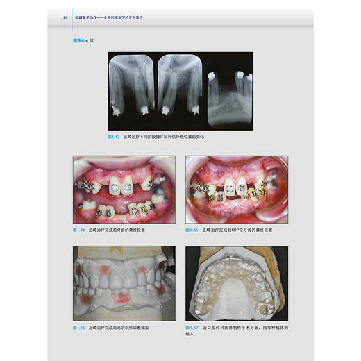 【出版社代发】超越单牙治疗 全牙列视角下的牙科诊疗 胥春 范震 主译 为患者提供全面诊断并制订综合治疗计划 辽宁科学技术出版社 商品图4