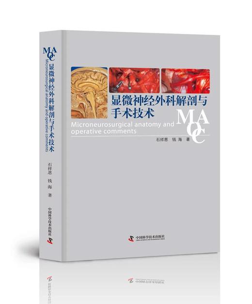 显微神经外科解剖与手术技术 石祥恩 商品图0