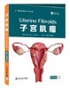 子宫肌瘤 结合临床实际，紧贴医患共同关注的子宫肌瘤问题 商品缩略图0