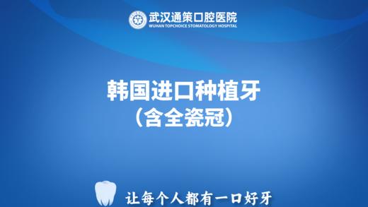 韩国进口|种植牙套餐（含全瓷冠） 商品图0