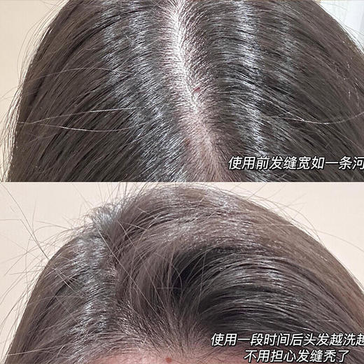 【分仓直发包邮】滋源生姜强根健发防脱洗头水535ml（油性） 商品图2