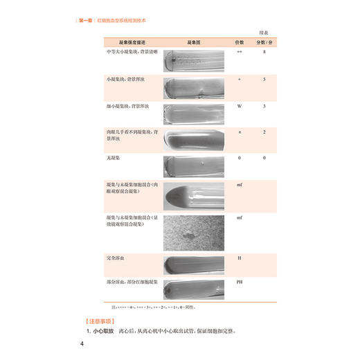 临床输血学检验技术实验指导 第2二版 十四五规划教材 全国高等学校教材 桂嵘 主编 供医学检验技术专业用 本科配教人民卫生出版社 商品图4