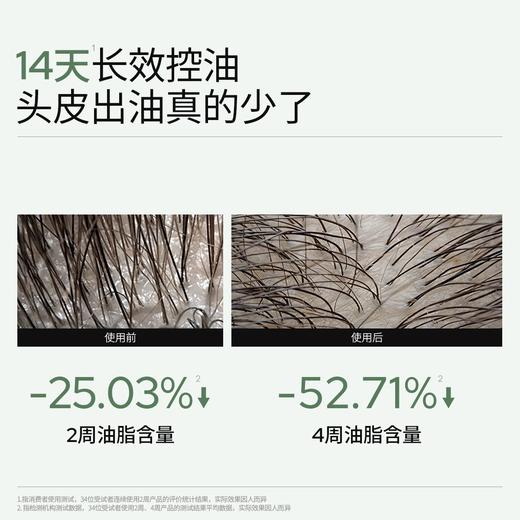 【77元捡漏】若也控油丰盈头皮喷雾70ml（效期到2026年4月29，介意者勿拍） 商品图2