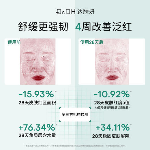 【精简修护】敏肌日常精简护肤套装 商品图4